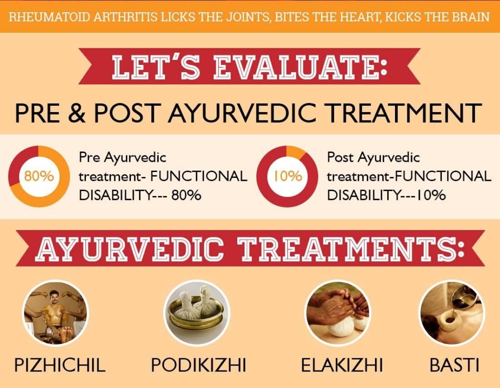 Ayurvedic treatment for Rheumatoid arthritis in Kerala, Calicut